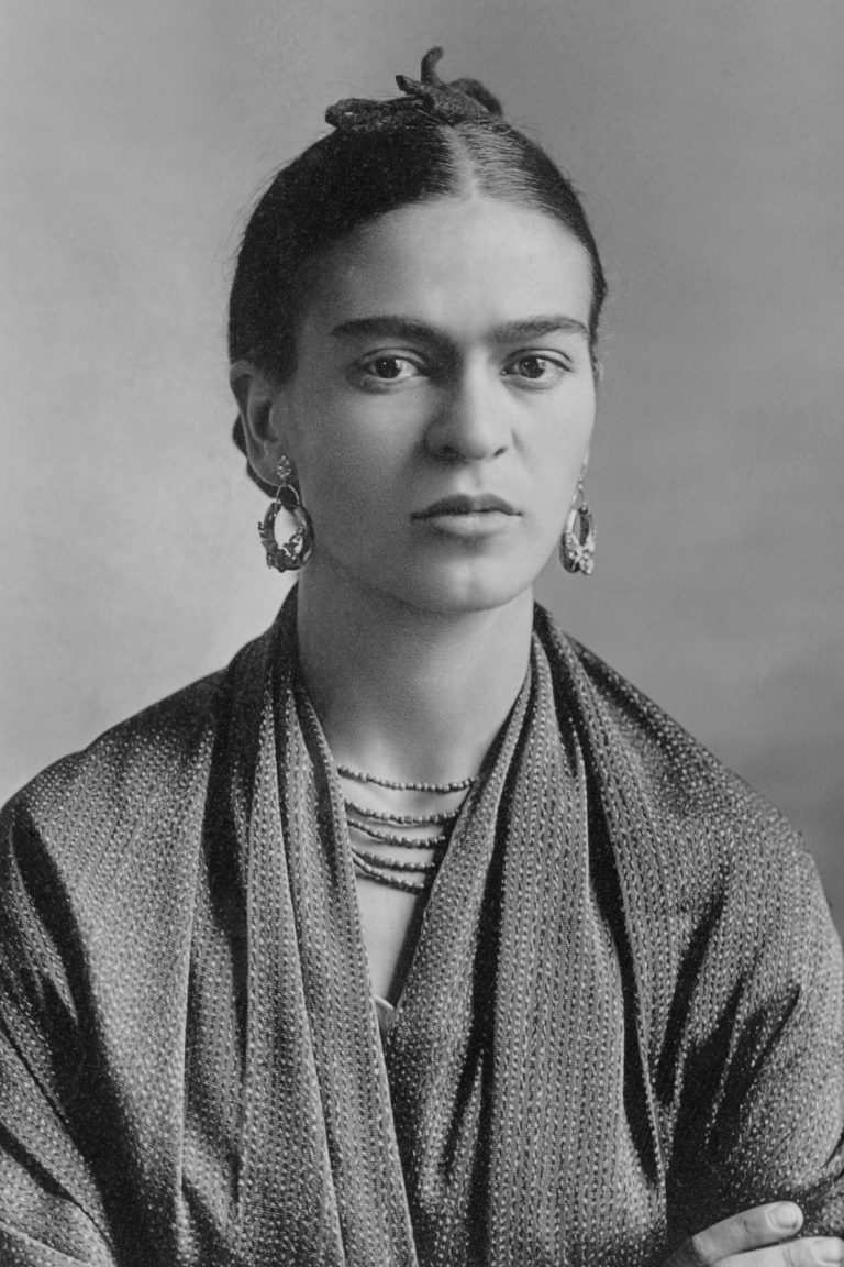 Frida Kahlo Todesursache